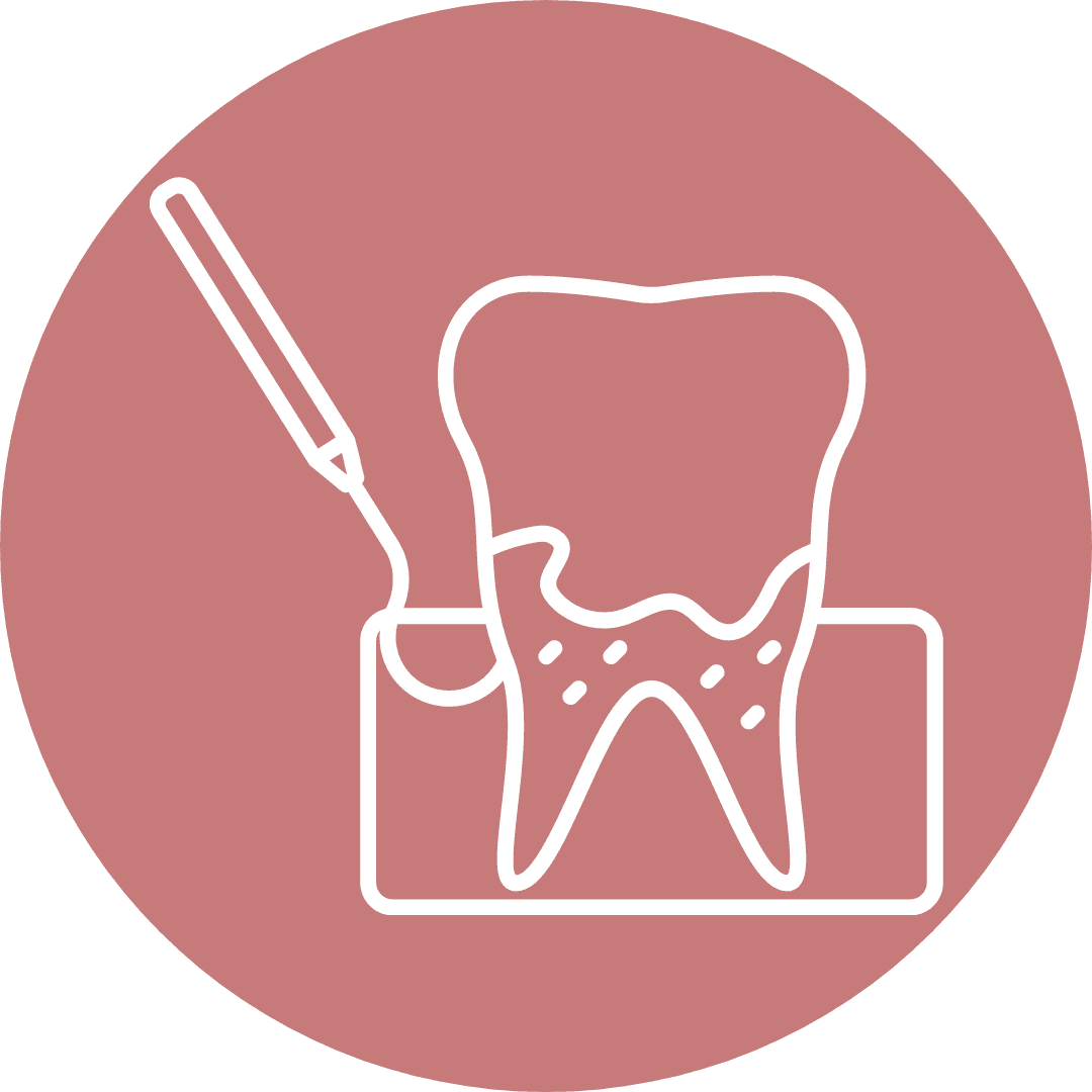 Ilustração do serviço Limpeza e raspagem periodontal